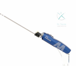 MicroAire power-assisted liposuction handpiece used for lymphatic-sparing lipedema reduction surgery.
