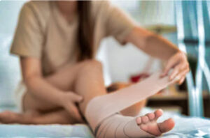 female patient doctor consultation leg swelling compression therapy