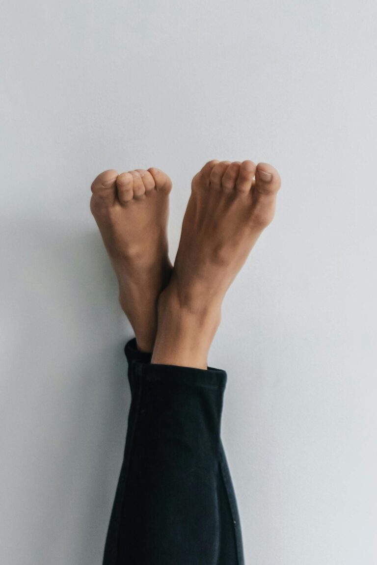 Lipedema